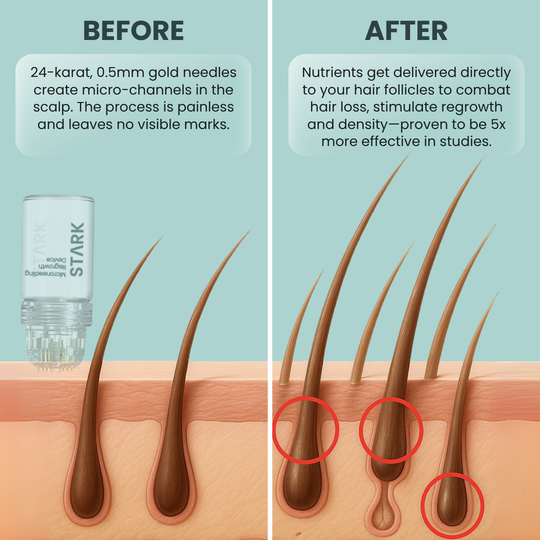 Stark One™ Regrowth Kit