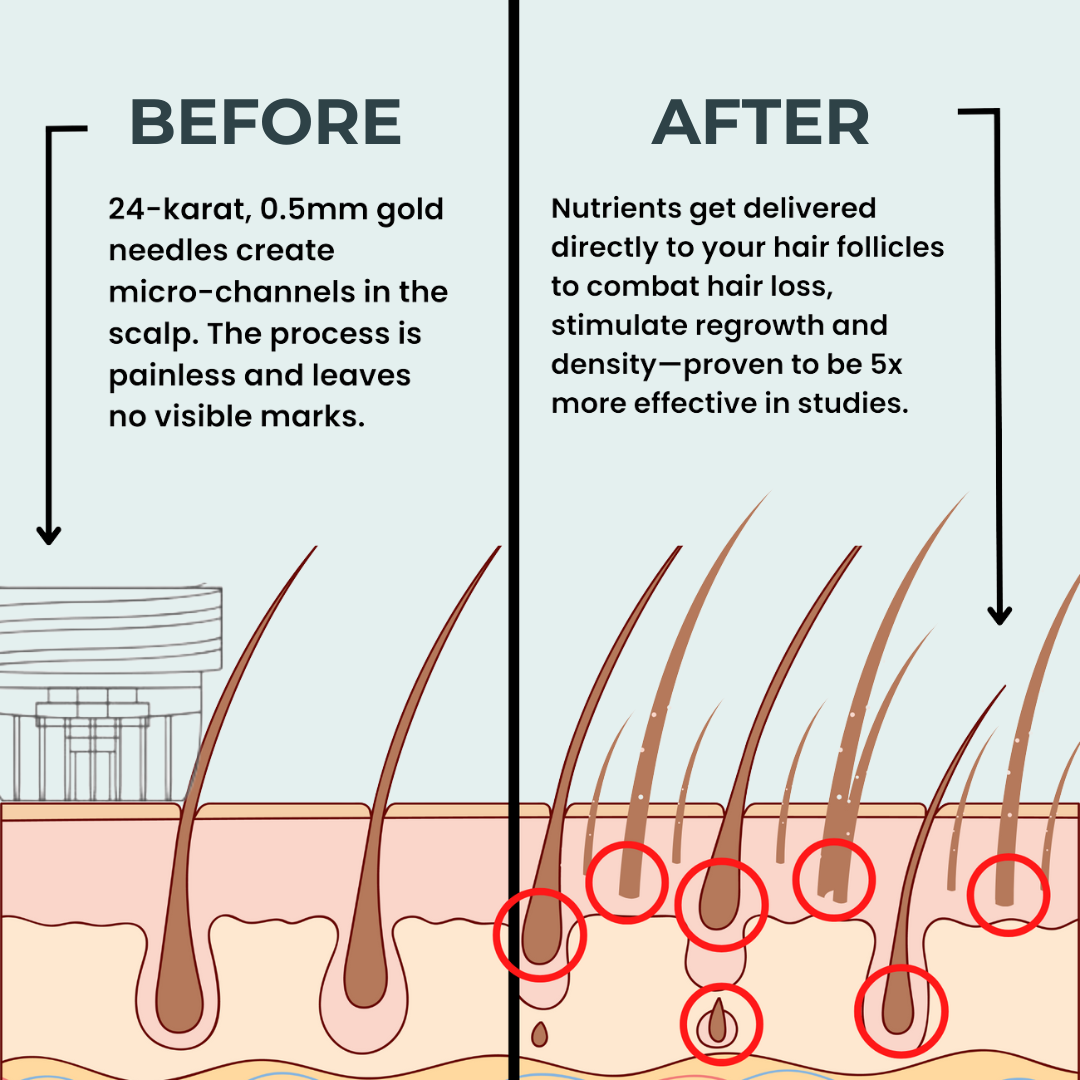 Stark One™ - Hair Regrowth Kit