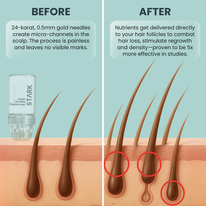 Stark One™ Regrowth Kit